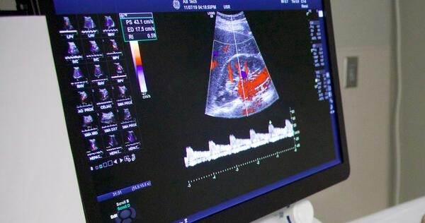 Advanced in-office sonogram ultrasound diagnostic imaging